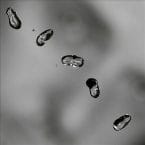 UP (2LP) (VINYL/DOWNLOAD)